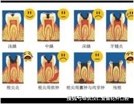 牙齿洞怎么办