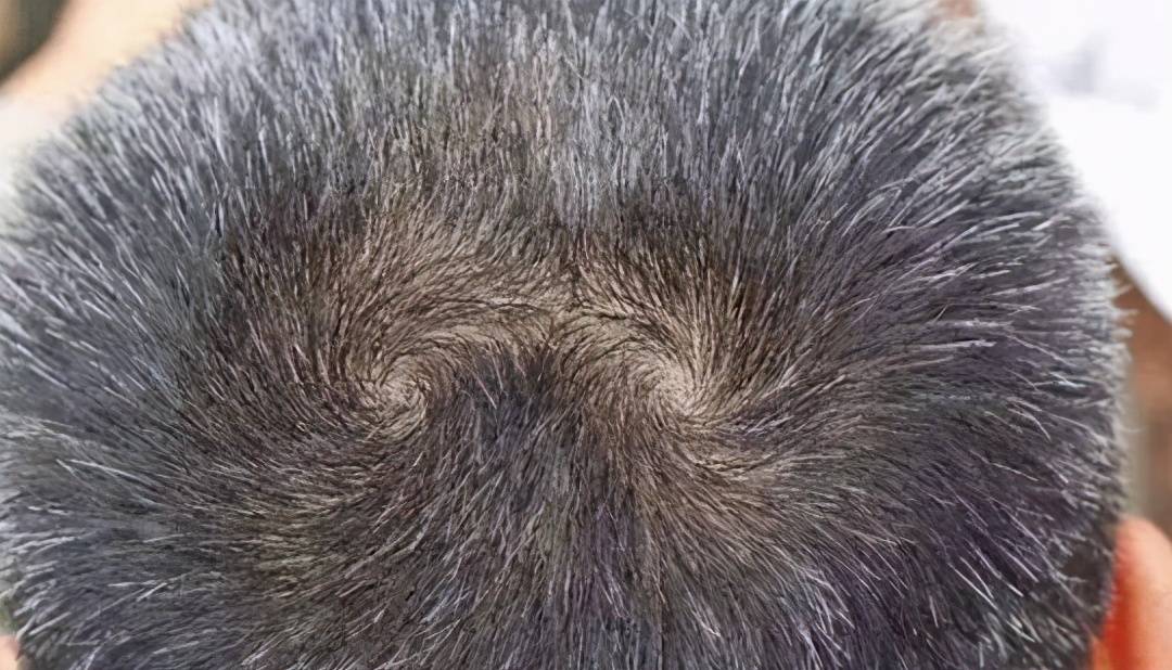 头顶一个旋和两个旋的孩子有何区别?科学解释来了,家长别无知_性格