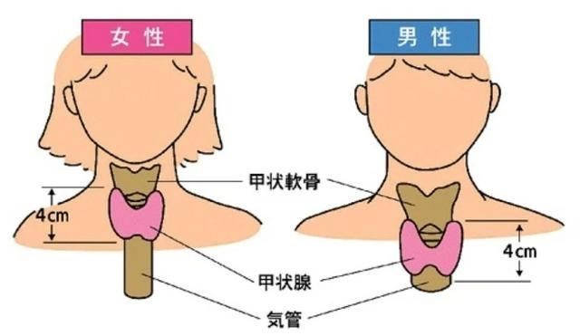 橋本氏甲狀腺炎患者日常需要注意哪些問題