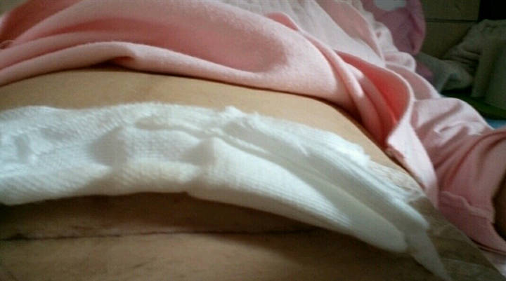 什么情况才要剖腹产 44858fe452334fd6b51e0027091c221b.jpeg