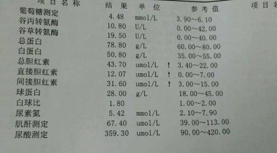 肝肾功能检查单图片