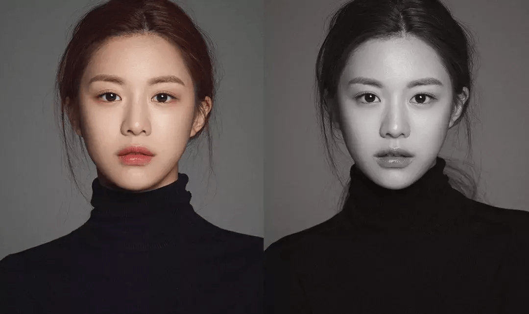 韩国第一整容模板高允真也被整毁了 人造美人太难当了 脸蛋