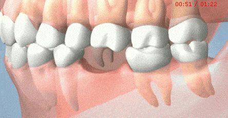 f084953fc25e423693f8db27236e07f6.gif