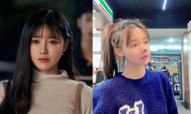 女网红花60万整容换脸 磨骨隆鼻险毁容后又多次整容 脸肿僵硬极不自然 手术