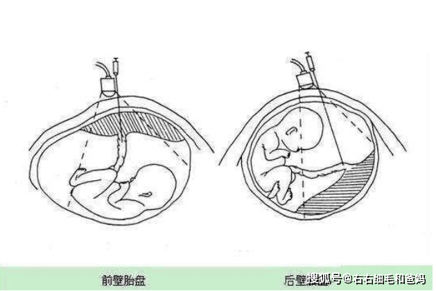 32b6340fa9894bedbaef6b4b21d57c6b.png
