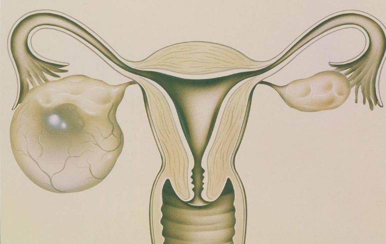 女性卵巢 真实图片