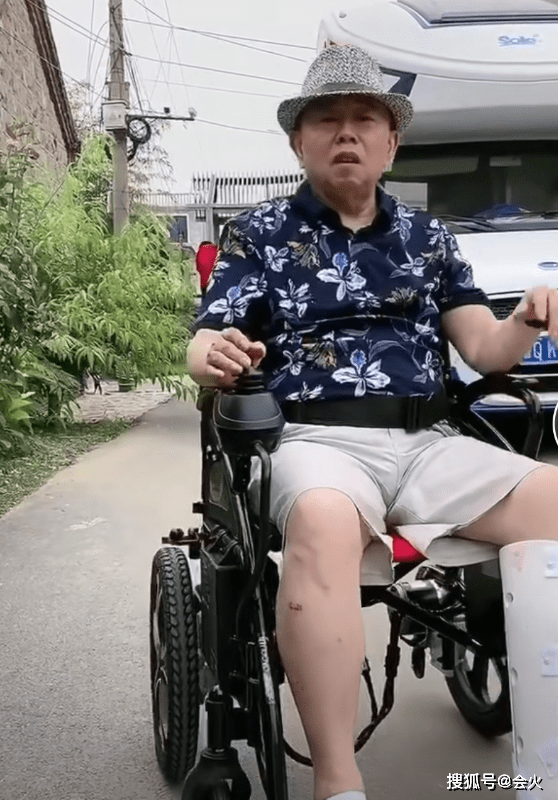 实际上他在拍电影时,因为拍戏受伤,小腿骨折,不得不坐在轮椅上表演