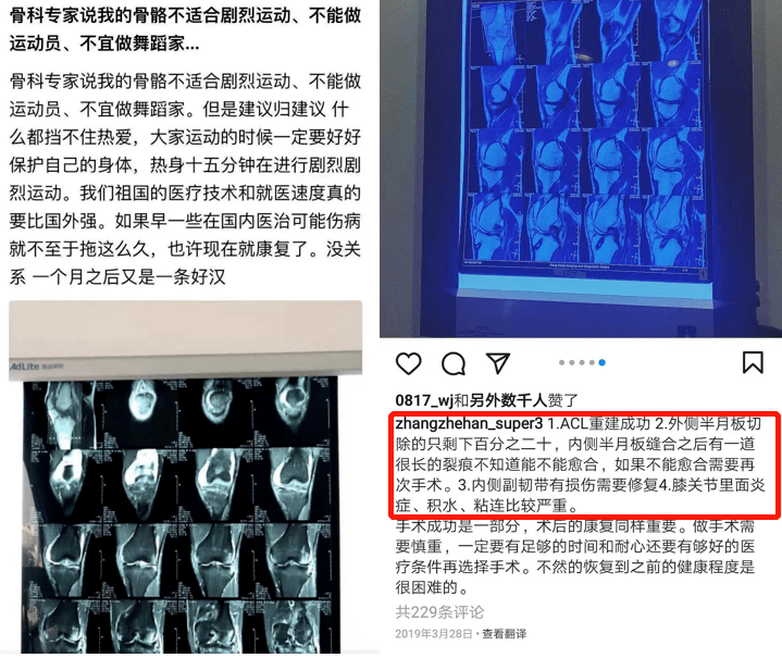 热爱运动的张哲瀚,膝盖有很严重的伤病