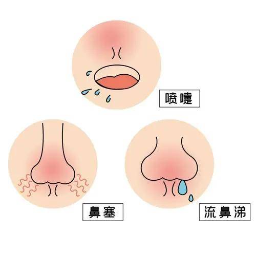 狐大医 | 换季不敢出游?重度鼻炎患者日常生活注意这六点