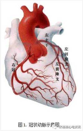 冠状动脉循环示意图图片