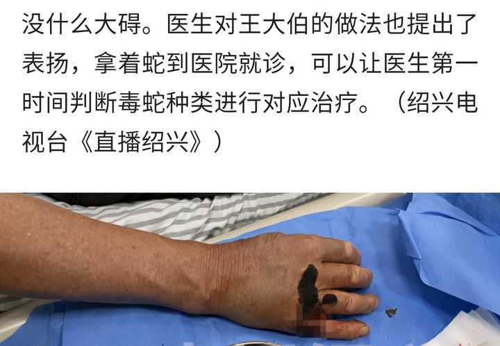 浙江一大爺打死了咬他的蛇,該蛇是受保護的