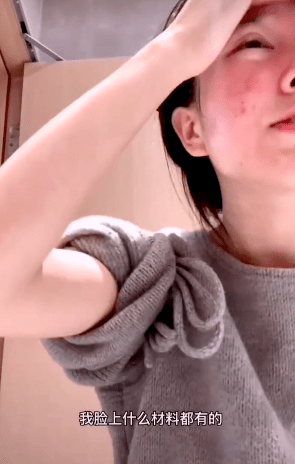 网红小霸宠承认整容!自称是后期合成,全脸几乎都动过,打了10次瘦脸针