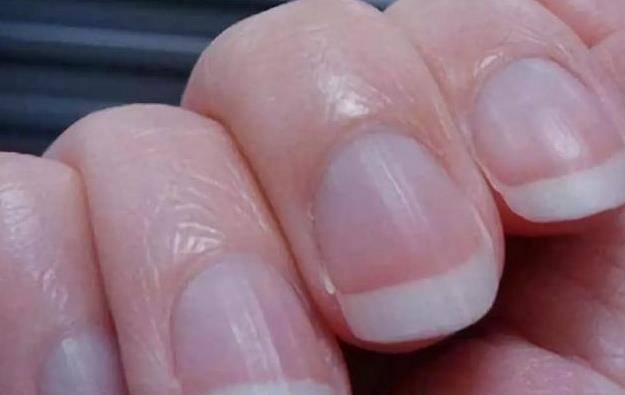 梦见剪指甲，解读梦境中的微妙暗示与心理寓意