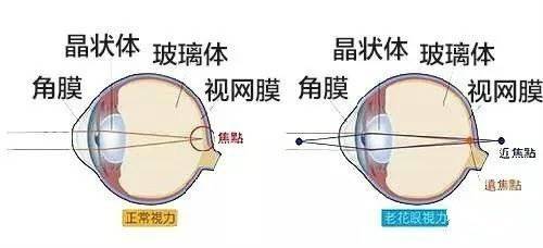影响视力的原因10条 a27aa383abbe4710b71975a15f65a92d.jpeg