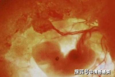 补孕酮最快 19ce2e71333f453ab1c2e83a8645bbef.jpeg