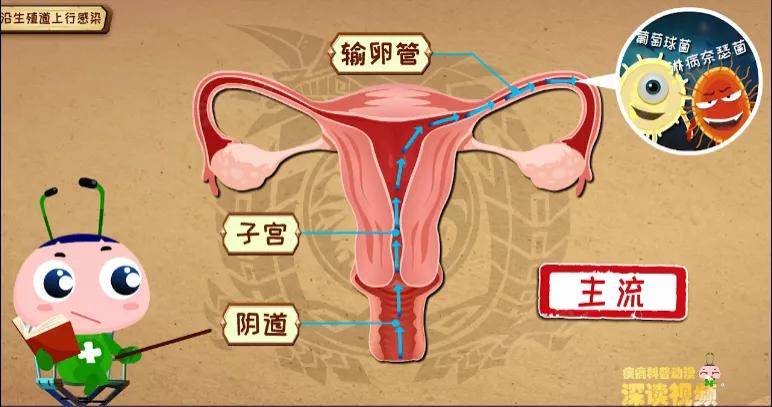 原创
输卵管炎咋来的?性生活过频、人流惹的祸?看动画教你做明白女人