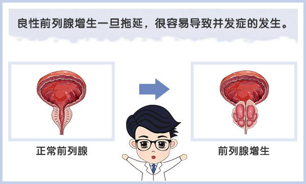 中老年男性留點心:起夜超過