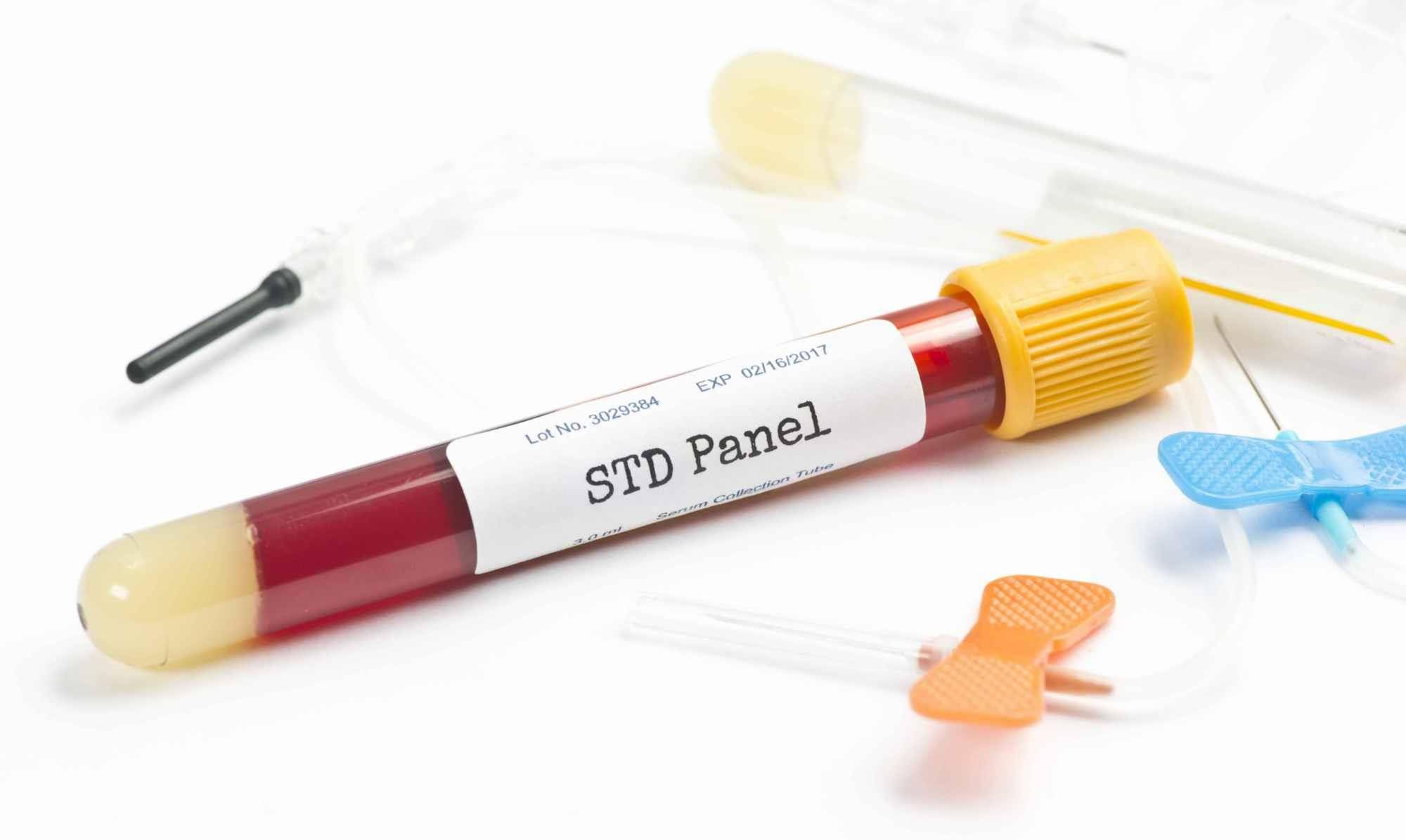 什么时候检查尿酸 239a0bd429024126bce5398a39ca3575.jpeg