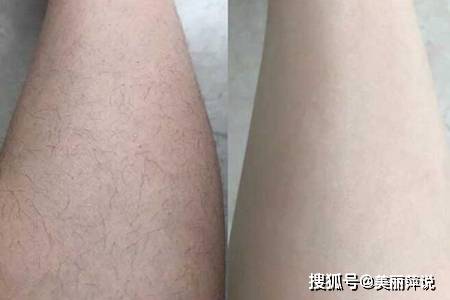 怎么去腿毛最有效 这三个女生去腿毛的方法 脱毛