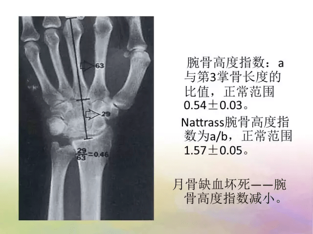 基础学习腕关节解剖详解