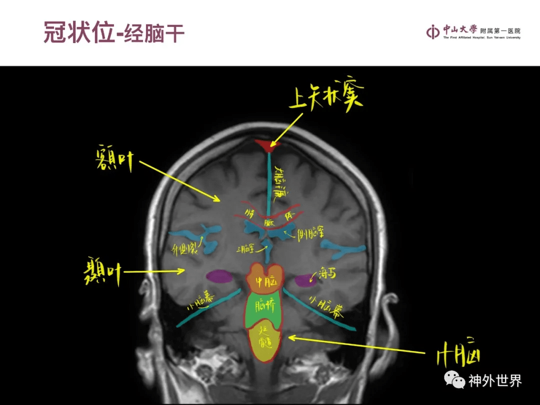 9b5ef6e5c32b458e87072ab08655941f.png