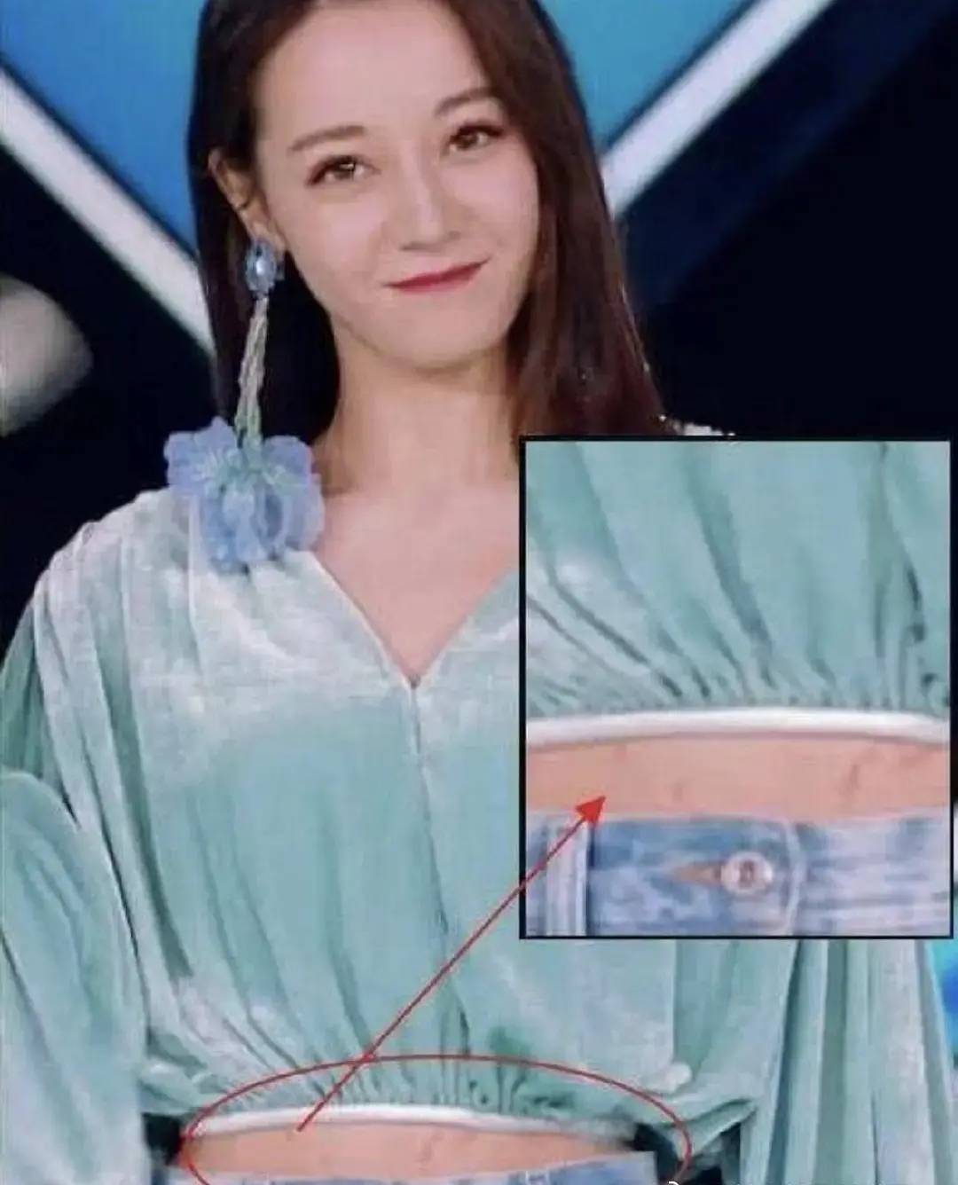 原创迪丽热巴肚子上有妊娠纹也有说是肥胖纹其实都不对那是伤疤