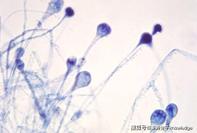 原創超20000人感染致死率高達50印度新疫情雪上加霜