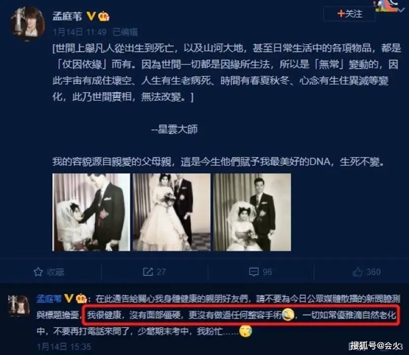 51岁孟庭苇皮肤白皙不见皱纹,网友:嘴怎么了?
