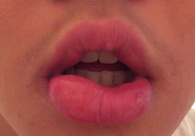 中医教你如何从唇色 读出 健康状态 4种唇色代表着不同的问题 嘴唇