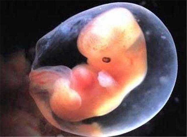 5个半月胎儿图片