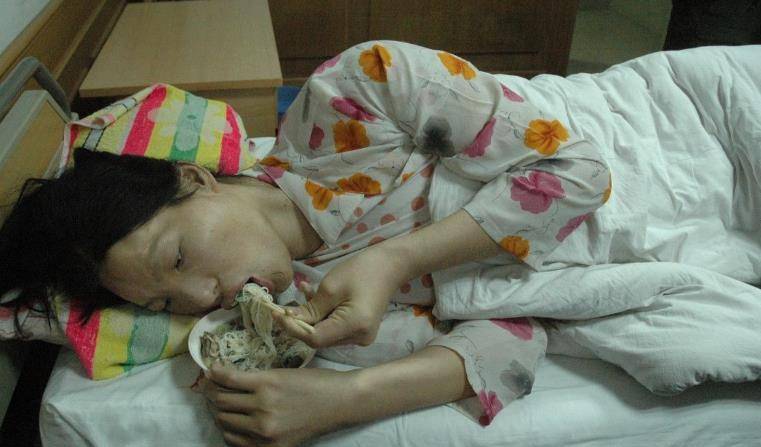 "世界第一女巨人":穿78码的鞋,一顿能吃两斤米饭,结局如何?