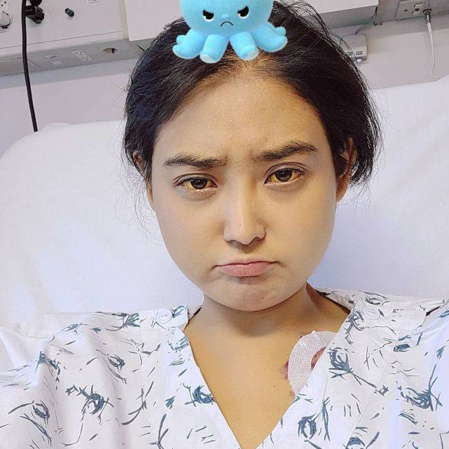 韩女星自曝因肝衰竭体重暴跌晒素颜照面容憔悴眼珠发黄