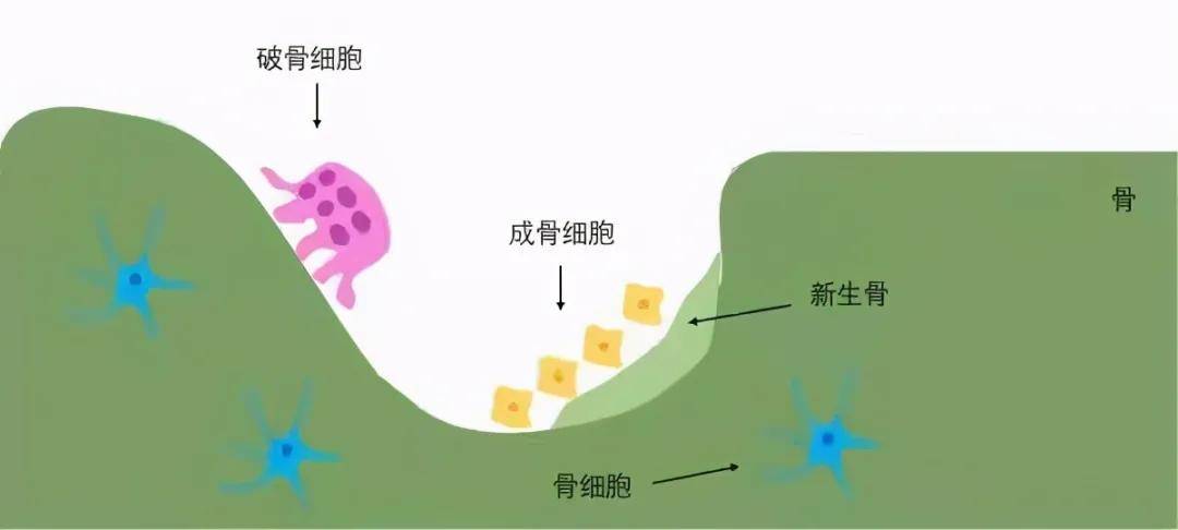 也有科学家经研究认为,失重环境打破了骨形成和骨吸收之间的细胞分子