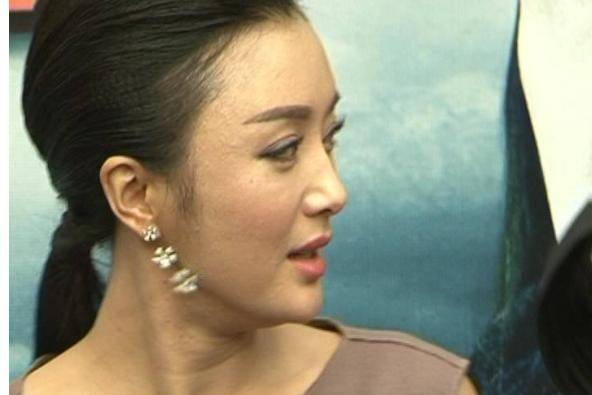 秦岚素颜曝光,整张脸都是疤?打脸娱乐圈