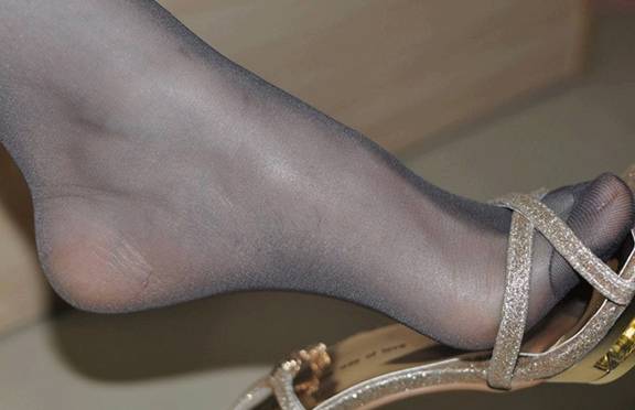 穿高跟鞋上台阶崴脚 5e97484f1f254022b3e4e4e31f4e8d1e.jpeg