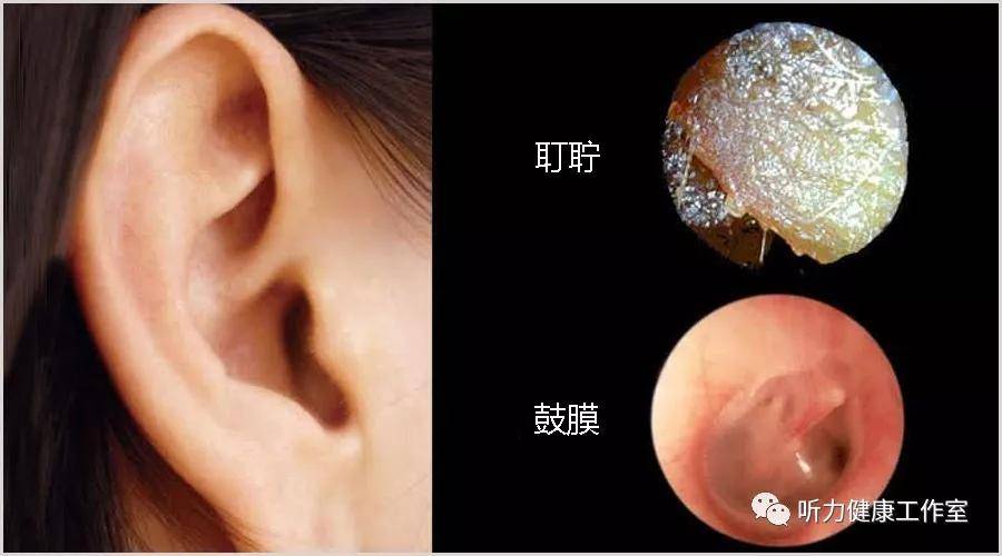 耳朵结构图及耳屎位置图片