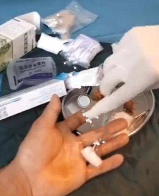  二驴夫妇真摊上事：售卖的山寨机发生爆炸 炸伤消费者(图4)