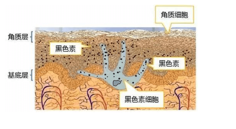 原创美白精华怎么选只看成分远远不够赶跑黑色素才是关键