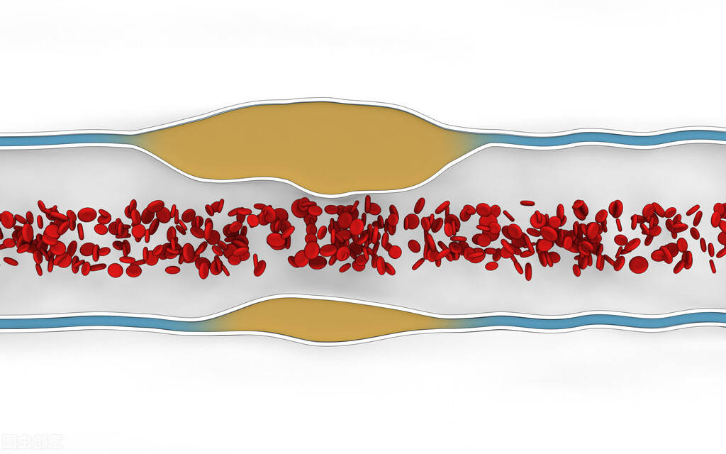 身体|怎么知道血管堵不堵？中医分享2个自查小方法，快来试一试