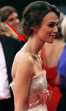 而脖子前倾是头和耳朵的位置落于肩膀的前方