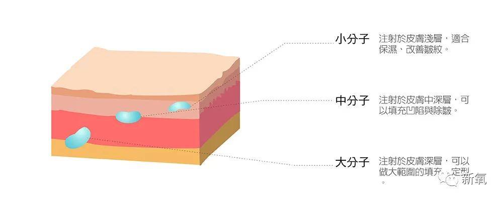 因为|和渣男分手后再出现的阚清子太好看了吧！脸小一整圈！