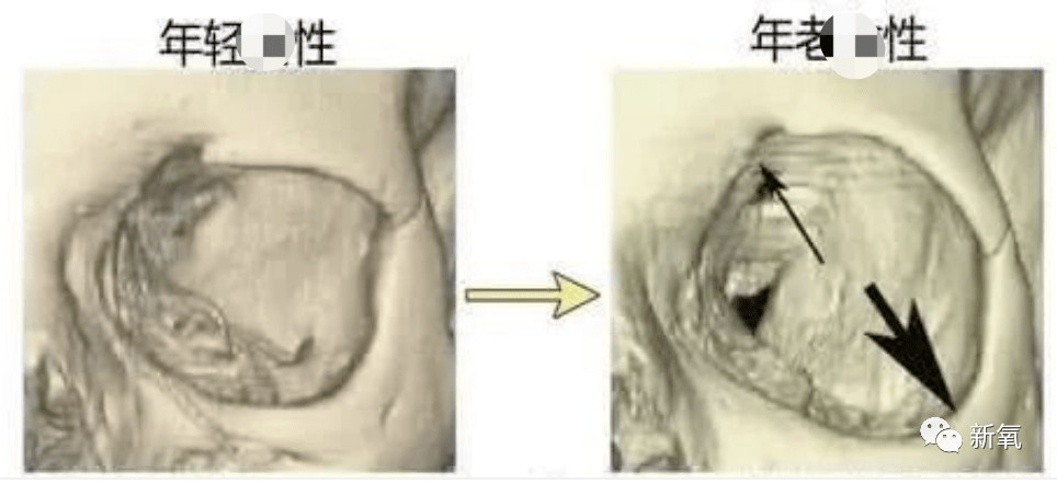 因为|和渣男分手后再出现的阚清子太好看了吧！脸小一整圈！