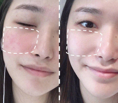 姐妹|水油平衡是什么?维持皮肤水油平衡的小妙招