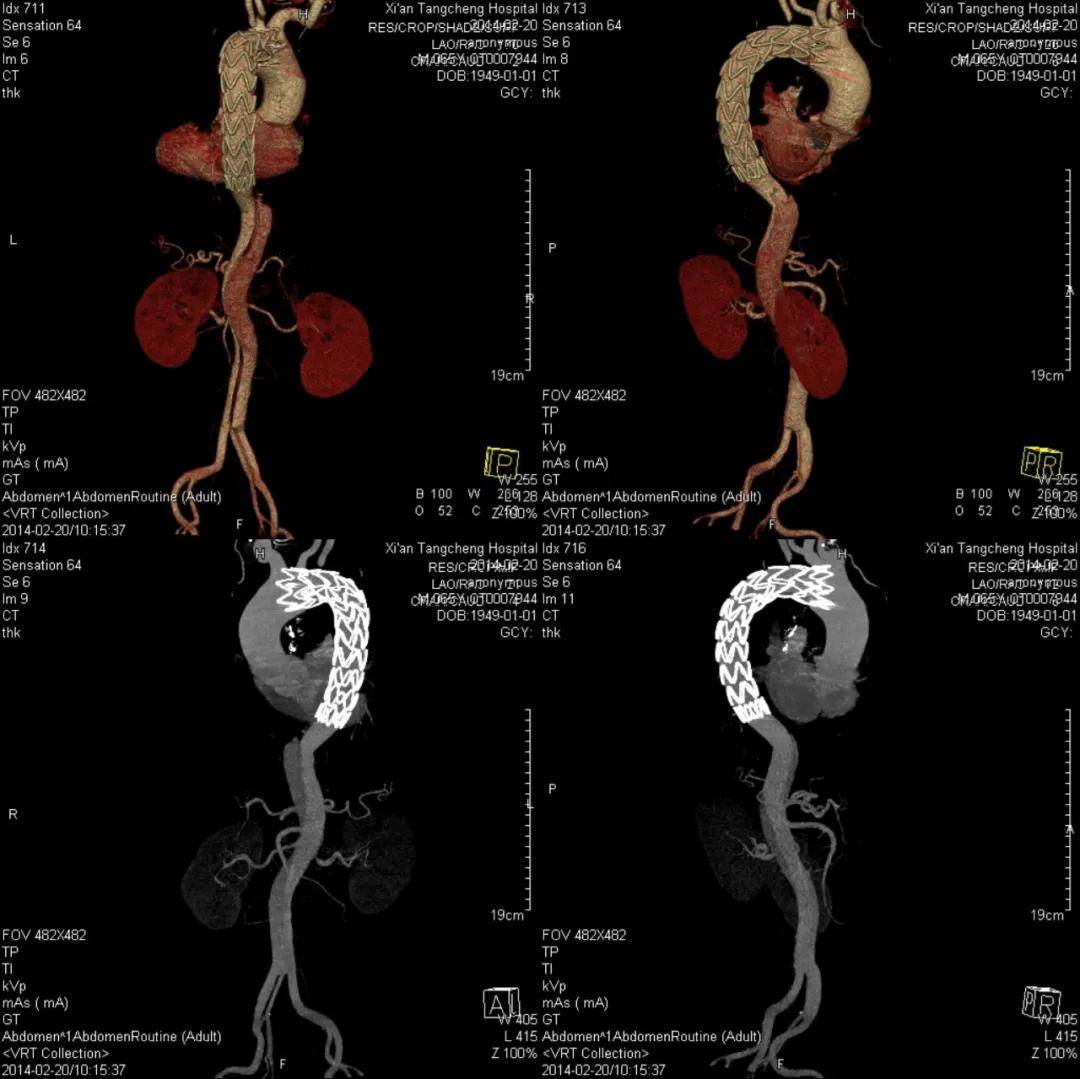 成像|【科室推荐】西安工会医院影像科