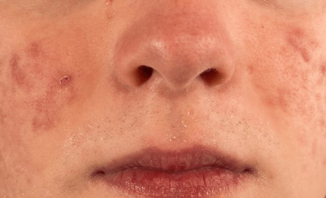 肝脏|登录 肝脏好不好,看脸就知晓?医生:若没有3种表现,肝还比较不错