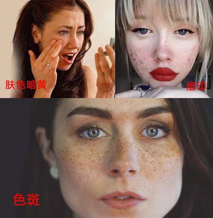 皮肤|爱兰诗 | 痘印色斑衰老接踵而至？一招轻松摆脱黄脸困扰！