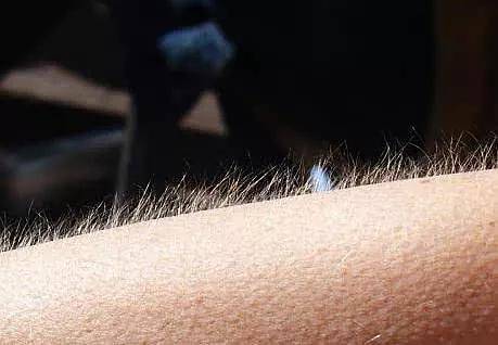 我们的皮肤表面长着汗毛,而每一个毛孔下都有一条竖毛肌,当受到神经