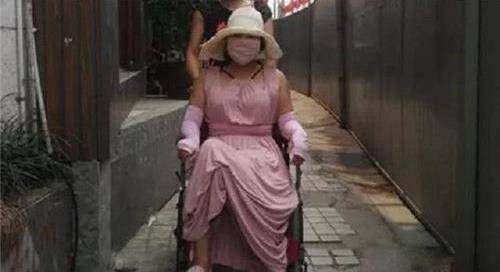 因为|红粉宝宝花400万,整容200多次,照片曝光后,网友:看久了会不适