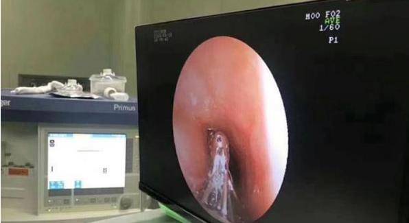 食品|5岁男宝哭闹肚子疼，没想到是宝妈贪便宜，买购的好零食惹的祸