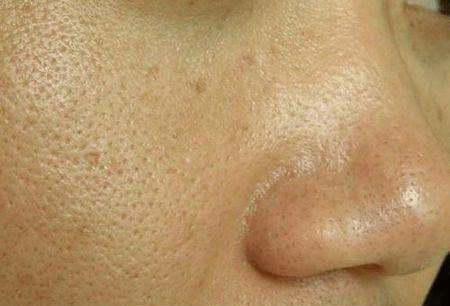 ec04097055be4e1789900bcb79ce866c.png